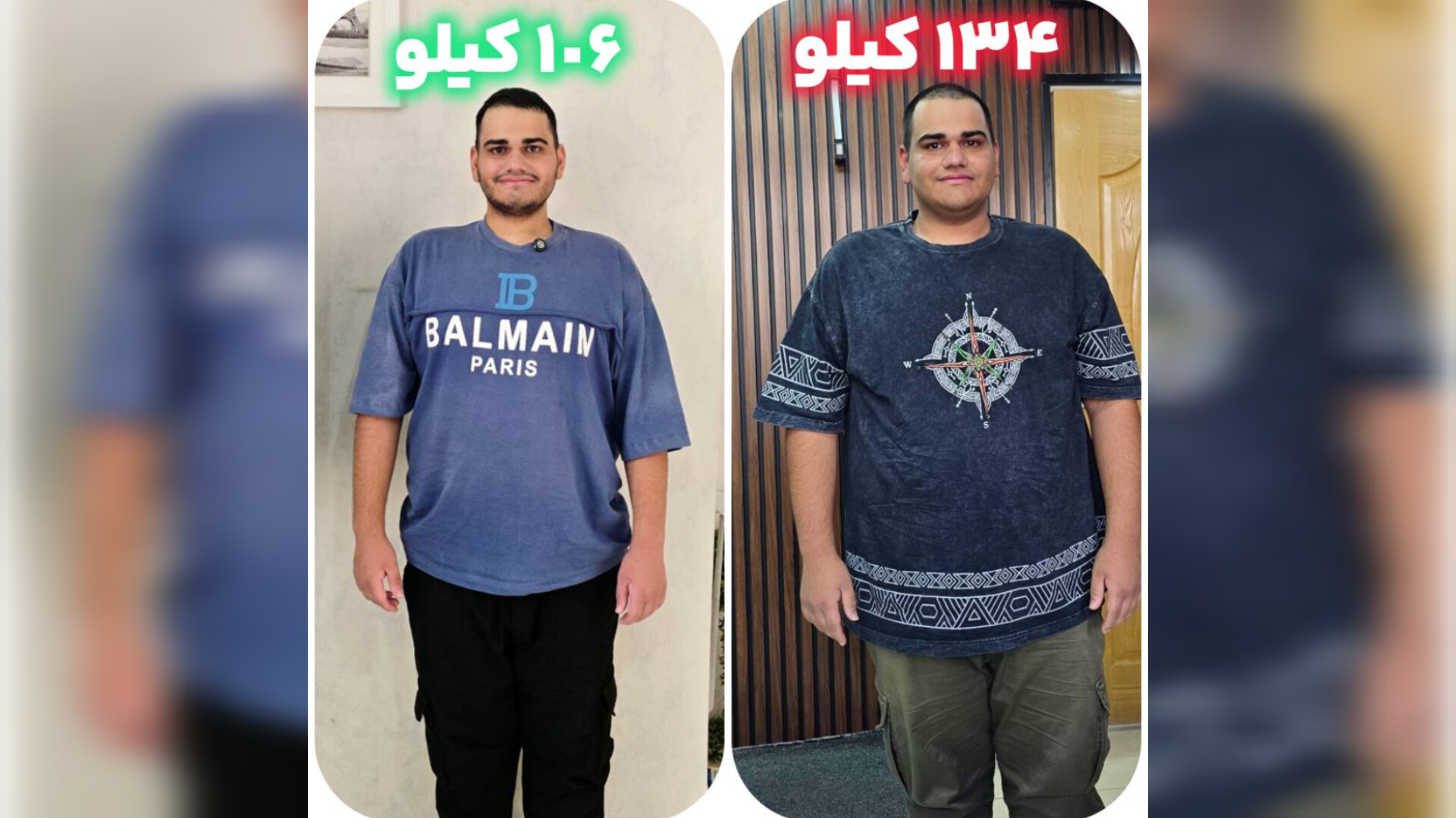 دوره اسلیو معده بدون جراحی